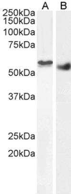 Western Blot: STK35 Antibody [NB100-1393] - Staining of nuclear HEK293 with antibody at 2 ug/mL (A) and Human Breast cancer with antibody at 1 ug/mL (B) lysate (35 ug protein in RIPA buffer). Detected by chemiluminescence.