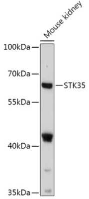 Western Blot: STK35 Antibody [NBP2-94423] - Analysis of extracts of Mouse kidney, using STK35 at 1:1000 dilution.Secondary antibody: HRP Goat Anti-Rabbit IgG (H+L) at 1:10000 dilution.Lysates/proteins: 25ug per lane.Blocking buffer: 3% nonfat dry milk in TBST.Detection: ECL Basic Kit .Exposure time: 90s.