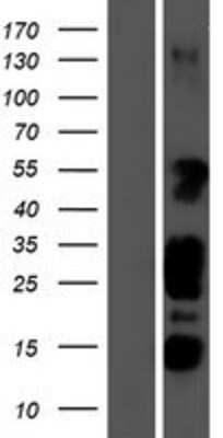 Western Blot: STK35 Overexpression Lysate (Adult Normal) [NBP2-10235] Left-Empty vector transfected control cell lysate (HEK293 cell lysate); Right -Over-expression Lysate for STK35.