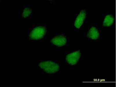 Immunocytochemistry/Immunofluorescence: STK36 Antibody [H00027148-B01P] - Analysis of purified antibody to STK36 on HeLa cell. (antibody concentration 10 ug/ml)