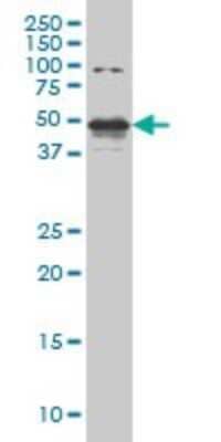 Western Blot: STK38 Antibody (2F3) [H00011329-M04] - Analysis of STK38 expression in Hela S3 NE (Cat # L013V3).