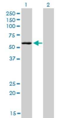 Western Blot: STK38 Antibody (2F3) [H00011329-M04] - Analysis of STK38 expression in transfected 293T cell line by STK38 monoclonal antibody (M04), clone 2F3. Lane 1: STK38 transfected lysatE (54.2 KDa). Lane 2: Non-transfected lysate.