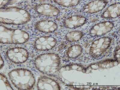 Immunohistochemistry-Paraffin: STK38 Antibody (2F6) [H00011329-M11] - Analysis of monoclonal antibody to STK38 on formalin-fixed paraffin-embedded human colon. Antibody concentration 2 ug/ml