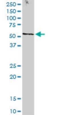 Western Blot: STK38 Antibody (2F6) [H00011329-M11] - Analysis of STK38 expression in human kidney.