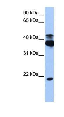 Western Blot: STK38 Antibody [NBP1-58362] - HepG2 cell lysate, concentration 0.2-1 ug/ml.