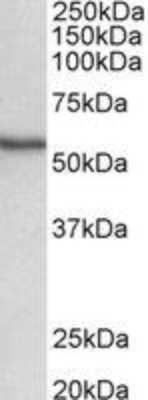 Western Blot: STK38 Antibody [NBP2-27552] - NBP2-27552 (0.5ug/ml) staining of Human Spleen lysate (35ug protein in RIPA buffer). Primary incubation was 1 hour. Detected by chemiluminescence.