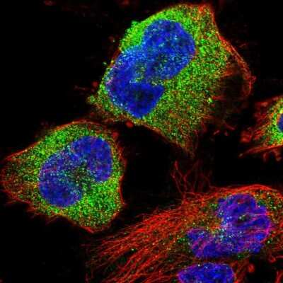 Immunocytochemistry/Immunofluorescence: STK38L Antibody [NBP2-57136] - Staining of human cell line U-251 MG shows localization to cytosol.