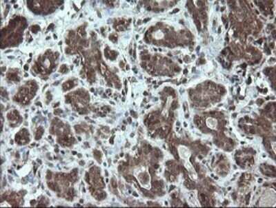 Immunohistochemistry: STK38L Antibody (OTI4D8) - Azide and BSA Free [NBP2-74403] - Analysis of Human breast tissue. (Heat-induced epitope retrieval by 10mM citric buffer, pH6.0, 120C for 3min)