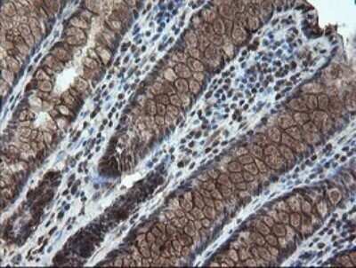 Immunohistochemistry: STK38L Antibody (OTI4D8) - Azide and BSA Free [NBP2-74403] - Analysis of Human colon tissue. (Heat-induced epitope retrieval by 10mM citric buffer, pH6.0, 120C for 3min)