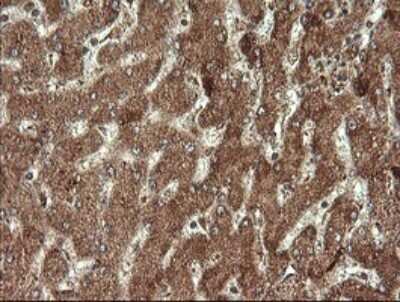 Immunohistochemistry: STK38L Antibody (OTI4D8) - Azide and BSA Free [NBP2-74403] - Analysis of Human liver tissue. (Heat-induced epitope retrieval by 10mM citric buffer, pH6.0, 120C for 3min)