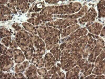 Immunohistochemistry: STK38L Antibody (OTI4D8) - Azide and BSA Free [NBP2-74403] - Analysis of Human pancreas tissue. (Heat-induced epitope retrieval by 10mM citric buffer, pH6.0, 120C for 3min)