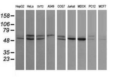 Western Blot: STK38L Antibody (OTI4D8) - Azide and BSA Free [NBP2-74403] - Analysis of extracts (35ug) from 9 different cell lines by using g STK38L monoclonal antibody (HepG2: human; HeLa: human; SVT2: mouse; A549: human; COS7: monkey; Jurkat: human; MDCK: canine; PC12: rat; MCF7: human).