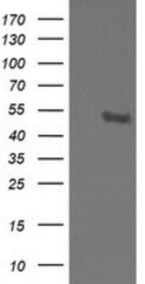 Western Blot: STK38L Antibody (OTI4D8) - Azide and BSA Free [NBP2-74403] - Analysis of HEK293T cells were transfected with the pCMV6-ENTRY control (Left lane) or pCMV6-ENTRY STK38L.