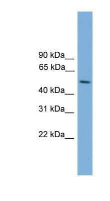 Western Blot: STK38L Antibody [NBP1-57030] - ACHN cell lysate, concentration 0.2-1 ug/ml.