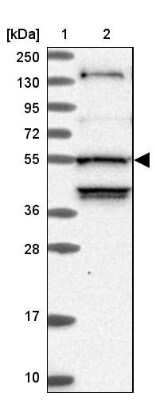 Western Blot: STK38L Antibody [NBP1-92454] - Lane 1: Marker  [kDa] 250, 130, 95, 72, 55, 36, 28, 17, 10.  Lane 2: Human cell line RT-4