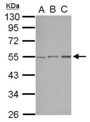 Western Blot: STK38L Antibody [NBP2-20518] - Sample (30 ug of whole cell lysate) A: A549 B: HepG2 C: HCT116 10% SDS PAGE gel, diluted at 1:1000.