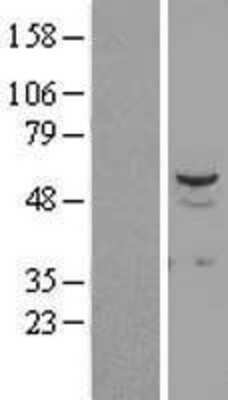 Western Blot: STK38L Overexpression Lysate (Adult Normal) [NBL1-16553] Left-Empty vector transfected control cell lysate (HEK293 cell lysate); Right -Over-expression Lysate for STK38L.