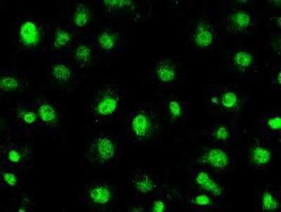 Immunocytochemistry/Immunofluorescence: STK39 Antibody (OTI4E3) - Azide and BSA Free [NBP2-74406] - Staining of COS7 cells using anti-STK39 mouse monoclonal antibody.