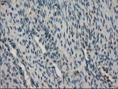 Immunohistochemistry: STK39 Antibody (OTI4E3) - Azide and BSA Free [NBP2-74406] - Staining of paraffin-embedded Human Ovary tissue using anti-STK39 mouse monoclonal antibody.