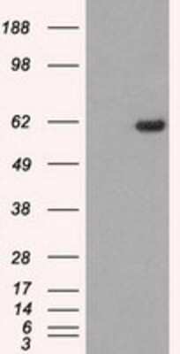 Western Blot: STK39 Antibody (OTI4E3) - Azide and BSA Free [NBP2-74406] - HEK293T cells were transfected with the pCMV6-ENTRY control (Left lane) or pCMV6-ENTRY STK39 (Right lane) cDNA for 48 hrs and lysed. Equivalent amounts of cell lysates (5 ug per lane) were separated by SDS-PAGE and immunoblotted with anti-STK39.