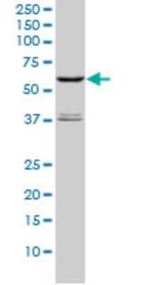 Western Blot: STK4 Antibody (1D7-8A10) [H00006789-M01] - STK4 monoclonal antibody (M01), clone 1D7-8A10 Analysis of STK4 expression in Hela S3 NE.