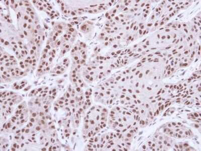 Immunohistochemistry-Paraffin: STK4 Antibody [NBP1-31233] - Cal27 xenograft, using MST1 antibody at 1:500 dilution. Antigen Retrieval: Citrate buffer, pH 6.0, 15 min.