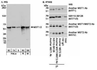 Immunoprecipitation: STK4 Antibody [NB110-39128] - Detection of MST1 and MST2 on HeLa whole cell lysate using NB110-39128. MST1 and MST2 were simultaneously IPed using other MST1/2 antibodies.