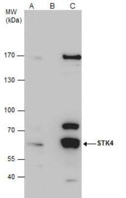 Immunoprecipitation: STK4 Antibody [NBP1-31233] - HepG2 whole cell extract A. 50 ug HepG2 whole cell extract B. Control with 4 ug of preimmune Rabbit IgG C. Immunoprecipitation of STK4 protein by 4 ug STK4 antibody 7.5 % SDS-PAGE The immunoprecipitated STK4 protein was detected by STK4 antibody diluted at 1:500. [EasyBlot anti-rabbit IgG was used as a secondary reagent]