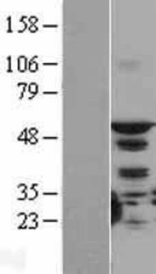 Western Blot: STK4 Overexpression Lysate (Adult Normal) [NBL1-16555] Left-Empty vector transfected control cell lysate (HEK293 cell lysate); Right -Over-expression Lysate for STK4.