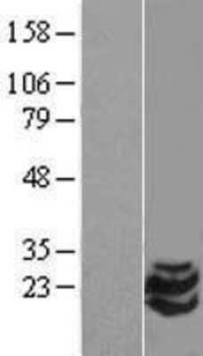 Western Blot: STMN2 Overexpression Lysate (Adult Normal) [NBL1-16558] Left-Empty vector transfected control cell lysate (HEK293 cell lysate); Right -Over-expression Lysate for STMN2.