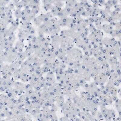 Immunohistochemistry-Paraffin: STMN3 Antibody [NBP1-80779] - Staining of human liver shows no positivity in hepatocytes.