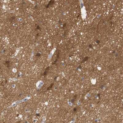 Immunohistochemistry-Paraffin: STMN3 Antibody [NBP1-80779] - Staining of human cerebral cortex shows moderate to strong cytoplasmic positivity in neurons.