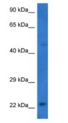 Western Blot STMN4 Antibody