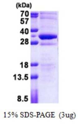 SDS-PAGE Recombinant Human STMN4 His Protein