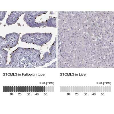 <b>Orthogonal Strategies Validation. </b>Immunohistochemistry-Paraffin: STOML3 Antibody [NBP2-62610] - Analysis in human fallopian tube and liver tissues using Anti-STOML3 antibody. Corresponding STOML3 RNA-seq data are presented for the same tissues.