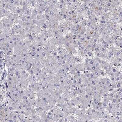 Immunohistochemistry-Paraffin: STOML3 Antibody [NBP2-62610] - Staining of human liver shows low expression as expected.