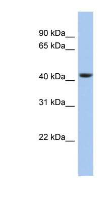 Western Blot: STOML3 Antibody [NBP1-62188] - 721_B cell lysate, concentration 0.2-1 ug/ml.