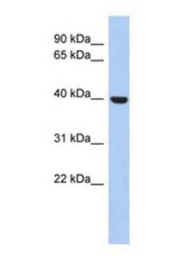 Western Blot: STOML3 Antibody [NBP1-69232] - This Anti-STOML3 antibody was used in Western Blot of 721_B     tissue lysate at a concentration of 1ug/ml.