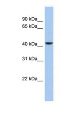 Western Blot: STOML3 Antibody [NBP1-69233] - This Anti-STOML3 antibody was used in Western Blot of 721_B     tissue lysate at a concentration of 1ug/ml.