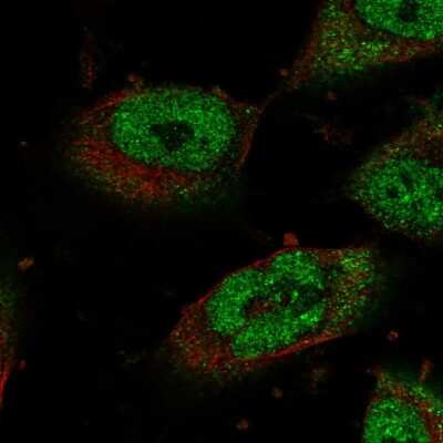 Immunocytochemistry/ Immunofluorescence STOX1 Antibody