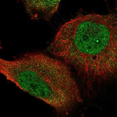 Immunocytochemistry/Immunofluorescence: STOX1 Antibody [NBP2-55177] - Staining of human cell line U-251 MG shows localization to nucleoplasm, nucleoli fibrillar center & cytosol.