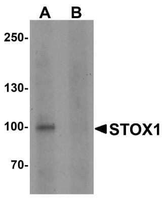 Western Blot: STOX1 Antibody [NBP2-82016] - Western blot analysis of STOX1 in human liver tissue lysate with STOX1 antibody at 1 ug/ml in (A) the absence and (B) the presence of blocking peptide.