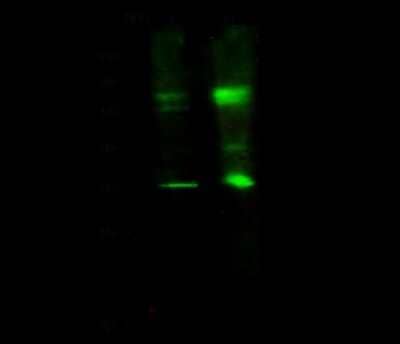 Western Blot: STRA8 Antibody [NBP2-98692] - Anti-STRA8 rabbit polyclonal antibody at 1:500 dilution. Lane A: HEK293 Whole Cell Lysate Lane B: 293 Whole Cell Lysate. Lysates/proteins at 30 ug per lane. Secondary Goat Anti-Rabbit IgG H&L (Dylight 800) at 1/10000 dilution. Developed using the Odyssey technique. Performed under reducing conditions. Predicted band size: 37 kDa. Observed band size: 35 kDa (We are unsure as to the identity of these extra bands).