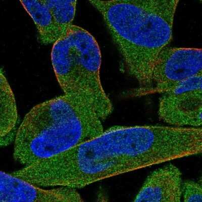 Immunocytochemistry/Immunofluorescence: STRIP1 Antibody [NBP2-56570] - Staining of human cell line RH-30 shows localization to cytosol. Antibody staining is shown in green.