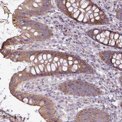 Immunohistochemistry-Paraffin: STRIP1 Antibody [NBP2-32528] - Staining of human colon shows moderate cytoplasmic positivity in glandular cells.