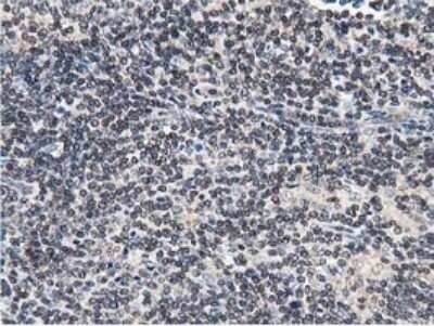 Immunohistochemistry: STRIP1 Antibody (OTI7B8) - Azide and BSA Free [NBP2-74408] - Analysis of Human lymphoma tissue.