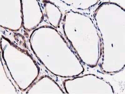 Immunohistochemistry: STRIP1 Antibody (OTI7B8) - Azide and BSA Free [NBP2-74408] - Analysis of Human thyroid tissue.
