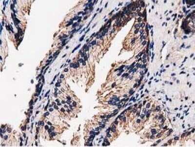 Immunohistochemistry: STRIP1 Antibody (OTI7B8) [NBP2-45715] - Analysis of Human prostate tissue.