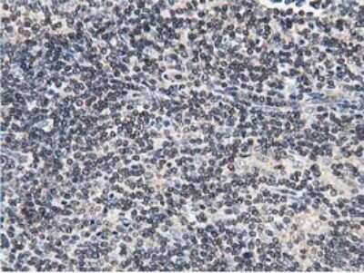 Immunohistochemistry: STRIP1 Antibody (OTI7B8) [NBP2-45715] - Analysis of Human lymphoma tissue.