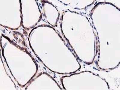 Immunohistochemistry: STRIP1 Antibody (OTI7B8) [NBP2-45715] - Analysis of Human thyroid tissue.